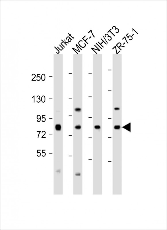 ARHGEF7 Antibody