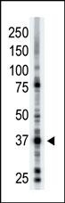 ART1 Antibody