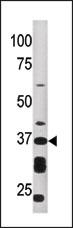 ART1 Antibody