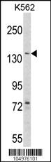 AGL Antibody