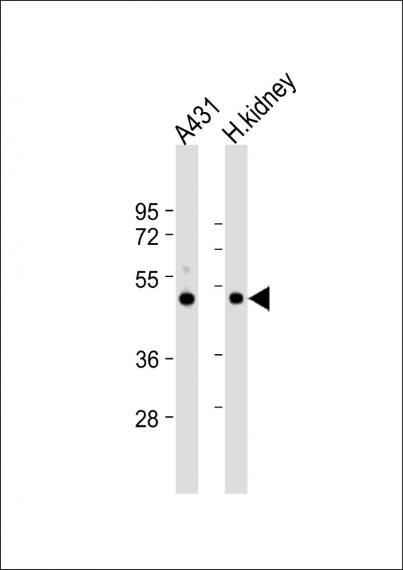 ZMPSTE24 Antibody
