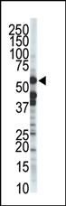 ZMPSTE24 Antibody