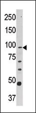 CPT1A Antibody
