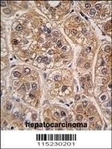 AKR1A1 Antibody