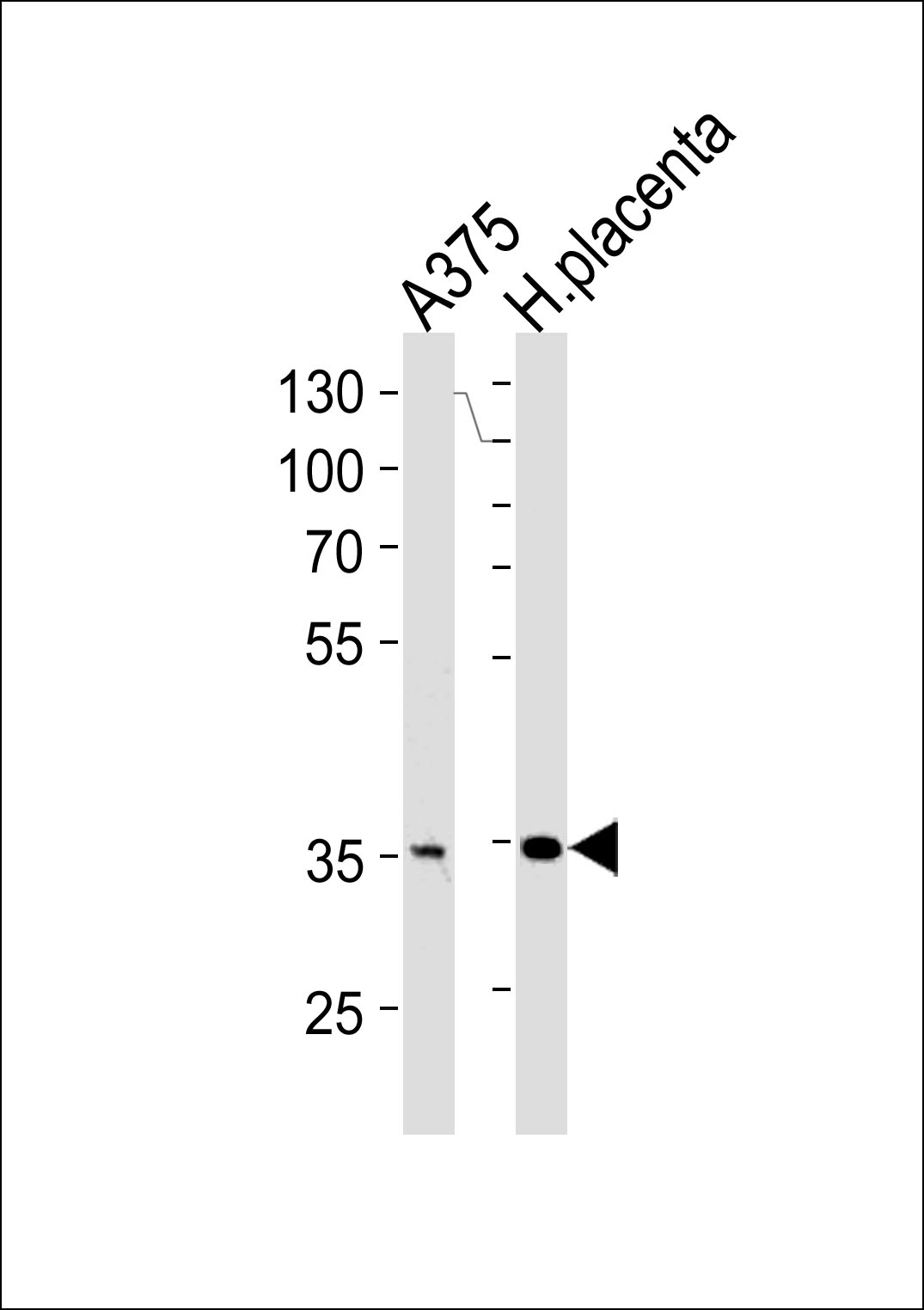 AKR1B1 Antibody