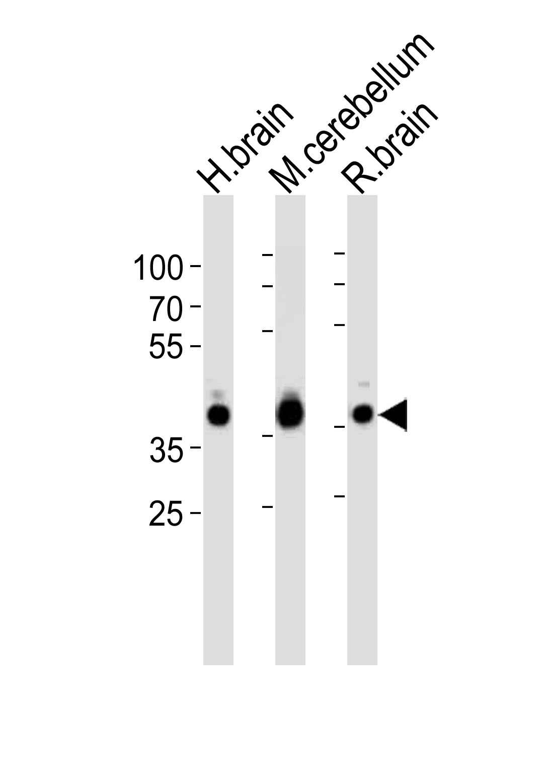 ALDOC Antibody