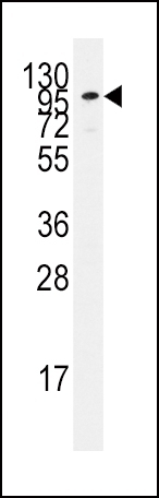 ADCY2 Antibody
