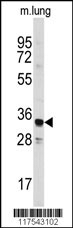 ANXA3 Antibody