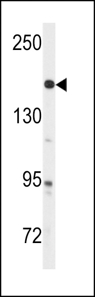 ABL Antibody