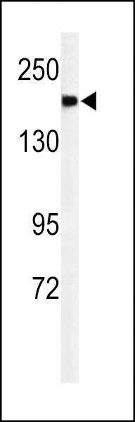 A2ML1 Antibody