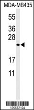 ZCH24 Antibody