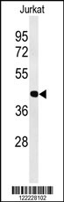 ATF1 Antibody