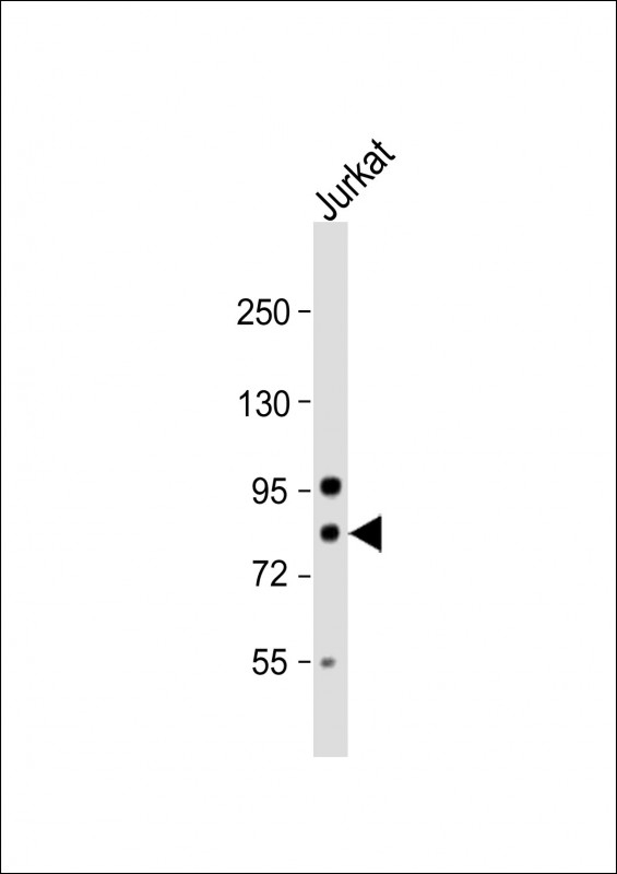 ARHGAP25 Antibody