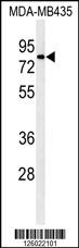 ATHL1 Antibody