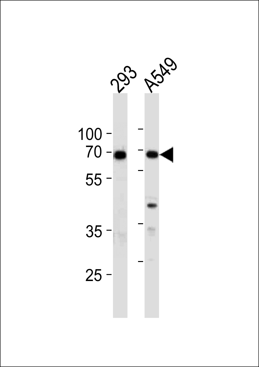 XRCC6 Antibody
