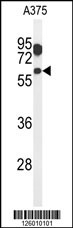 ZACN Antibody