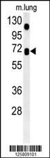 ASB15 Antibody