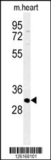 ATP4B Antibody