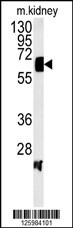 ATP6V1H Antibody