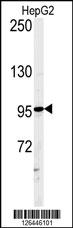 ATXN2L Antibody