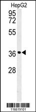 CCND1-Y226 Antibody