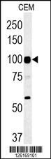 ATP6V0A4 Antibody