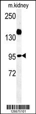 ARMC5 Antibody