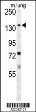 ATP11C Antibody