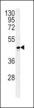 ADH1C Antibody