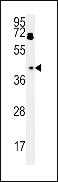 BDHA1 Antibody
