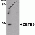 Western blot analysis of ZBTB9 in mouse heart tissue lysate with ZBTB9 antibody at 1 μg/mL in (A) the absence and (B) the presence of blocking peptide.