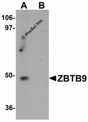 ZBTB9 Peptide