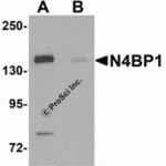Western blot analysis of N4BP1 in HeLa cell lysate with N4BP1 antibody at 0.5 μg/mL in (A) the absence and (B) the presence of blocking peptide.
