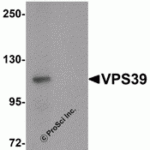 Western blot analysis of VPS39 in rat liver tissue lysate with VPS39 antibody at 0.5 μg/mL in (A) the absence and (B) the presence of blocking peptide.