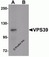 VPS39 Peptide