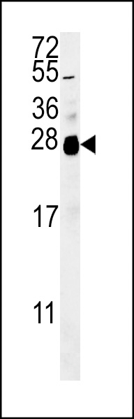 ZNF313 Antibody