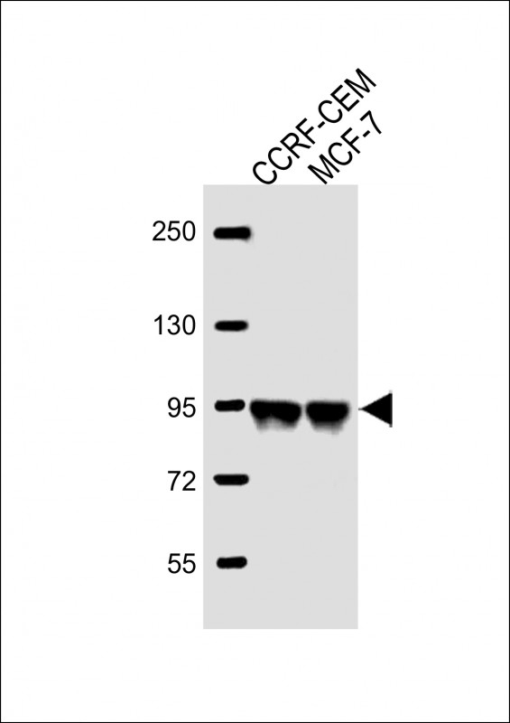 AFTPH Antibody