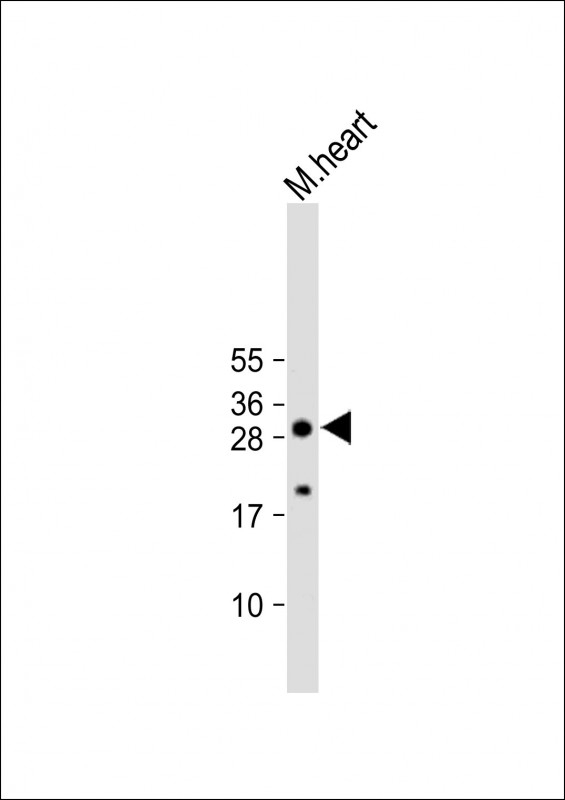 AQP11 Antibody