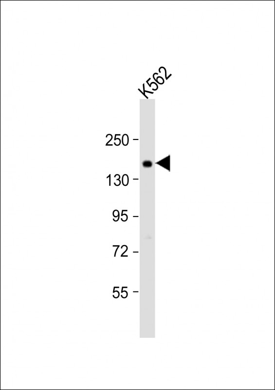 ADCY10 Antibody