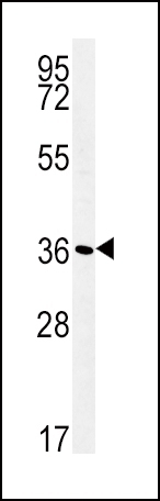 ATP1B1 Antibody