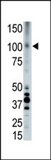 APOER2 Antibody