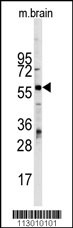 ZBTB7B Antibody