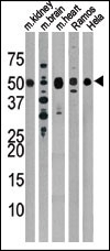 Drosophila Parkin Antibody