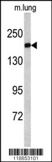 ALS2 Antibody