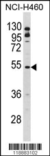 BLNK Antibody