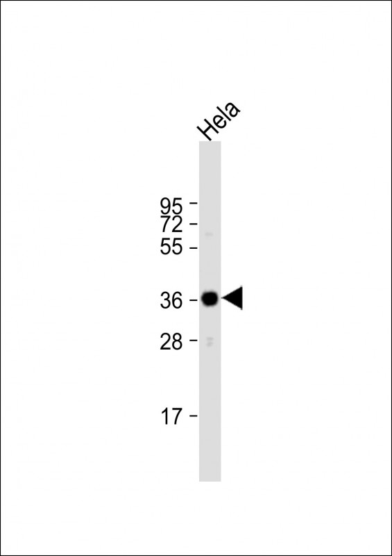 ARPC1A Antibody