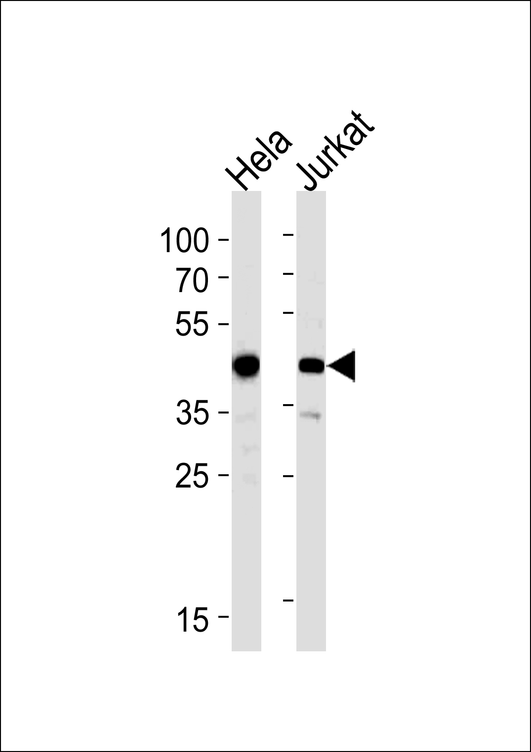 ACTR2 Antibody