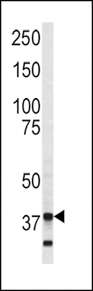 Annexin V Antibody