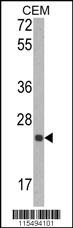TIMP1 Antibody