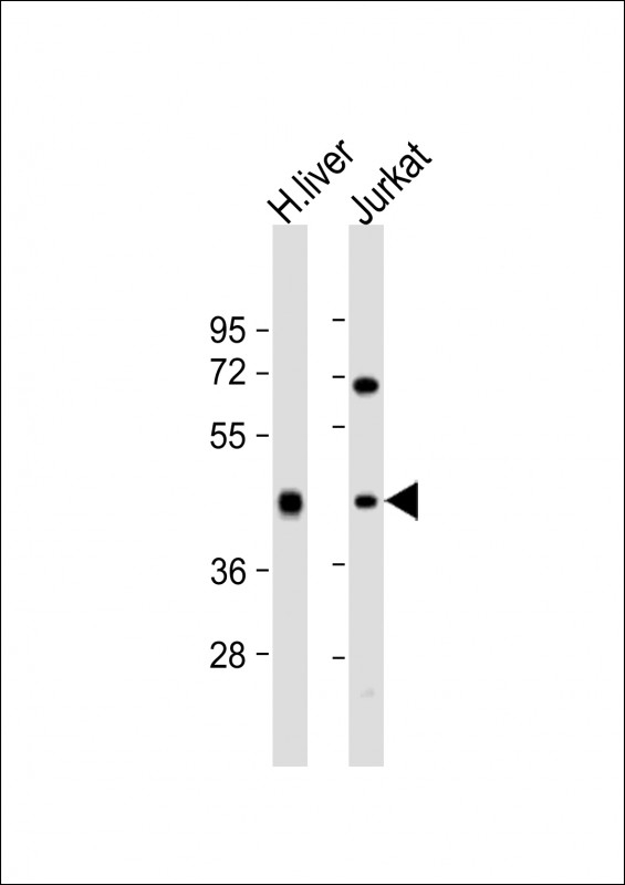 ADH1B Antibody